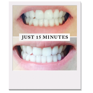 Teeth Whitening Kit 10PCS/6pcs/4pcs